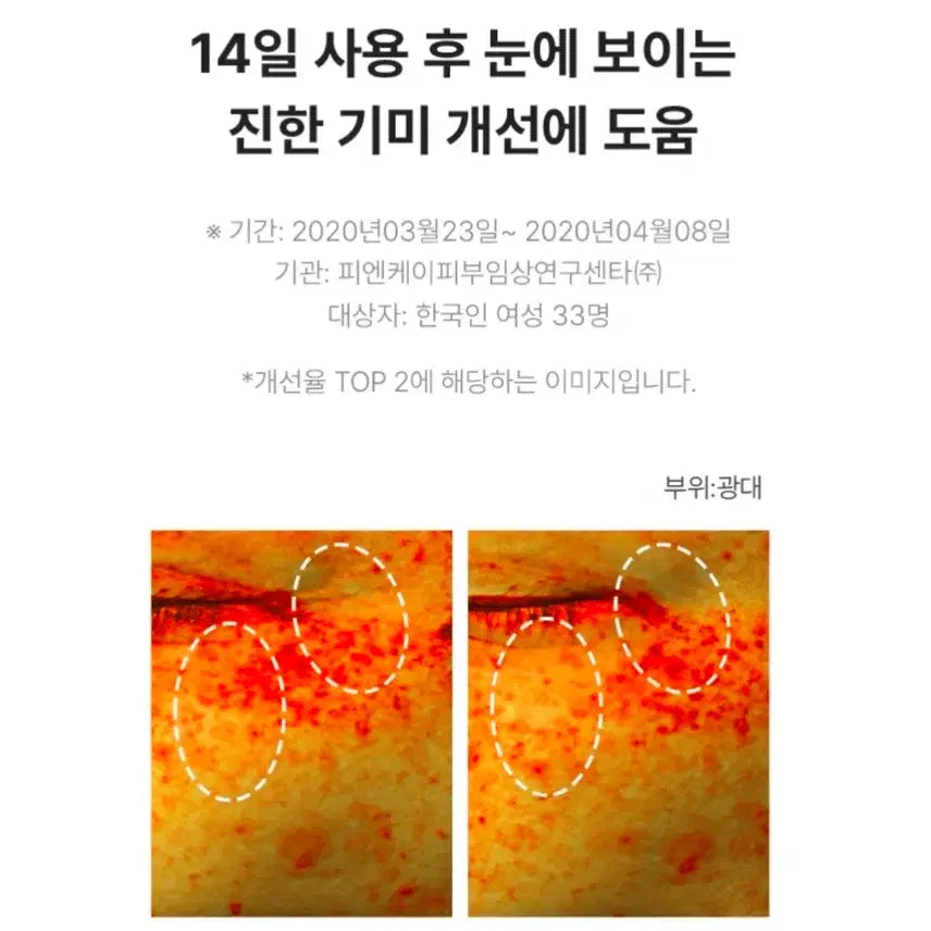 [BUNJANG] IOPE Brightening Dark Spot Essence (100ml) / 아이오페 브라이트닝 기미 에센스 총100ml