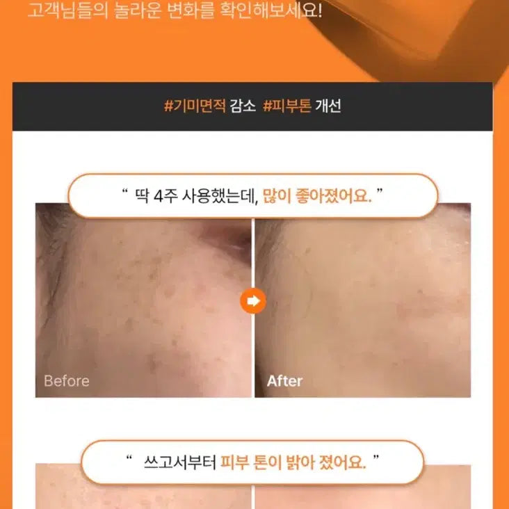 [BUNJANG] Visyna Melasma &amp; Dark Spot Cream / 새상품) 비시나 기미크림 흑자크림 (정가: 53,000)